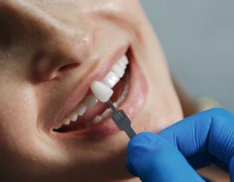 Имплантация зубов в Иркутске: что нужно знать пациенту