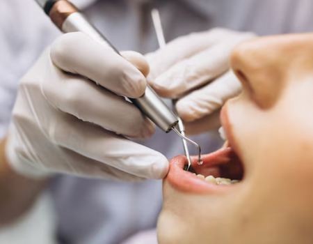 Подвижность зубов: причины, диагностика и лечение